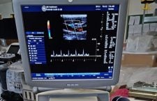 Парафія УПЦ з Кельна передала УЗД-апарат медичному центрі на Буковині